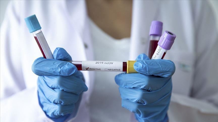 The coronavirus test in your city