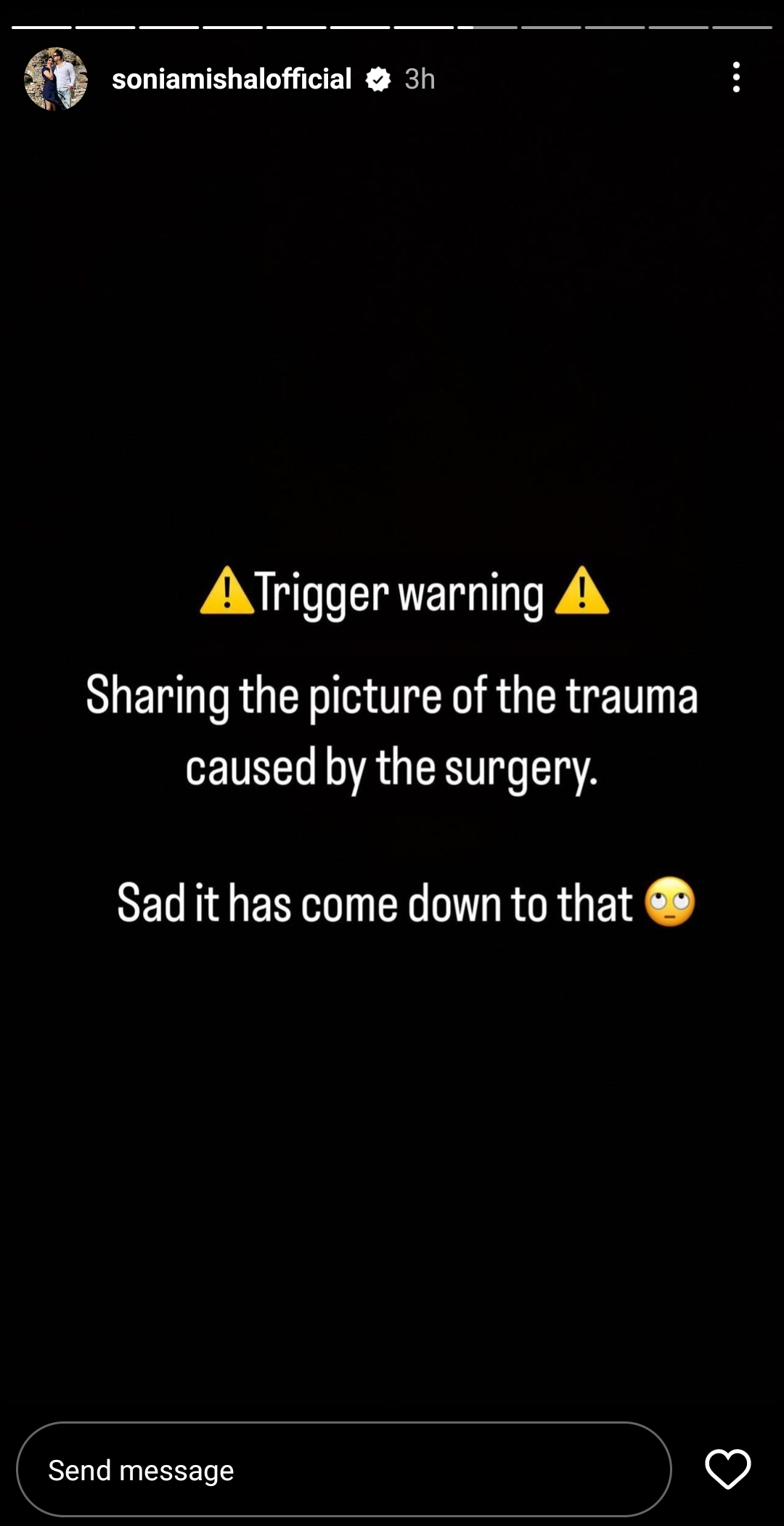 Sonia Mishal Addresses Hearsay About Her Cosmetic Surgery