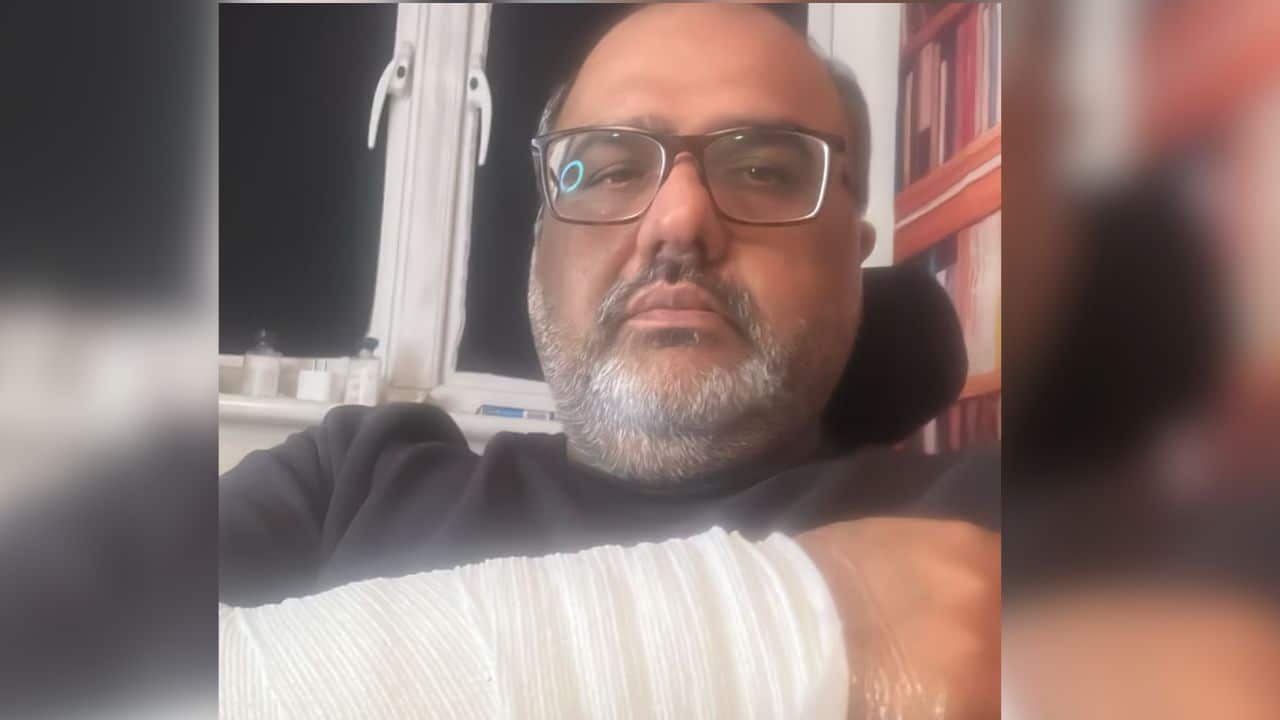 UK Police confirms acid attack on Shahzad Akbar