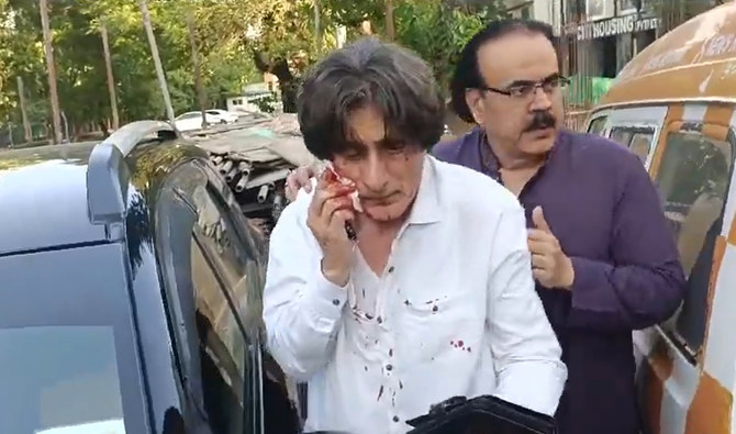 PTI’s spokesperson Raoof Hassan attacked by unknown people in Islamabad