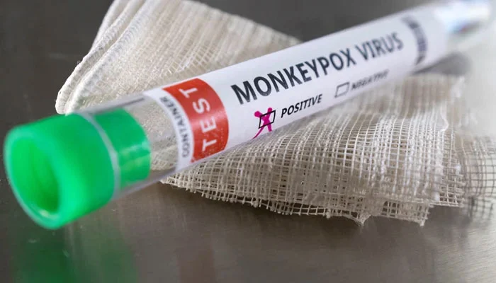 First case of monkeypox appears in Pakistan